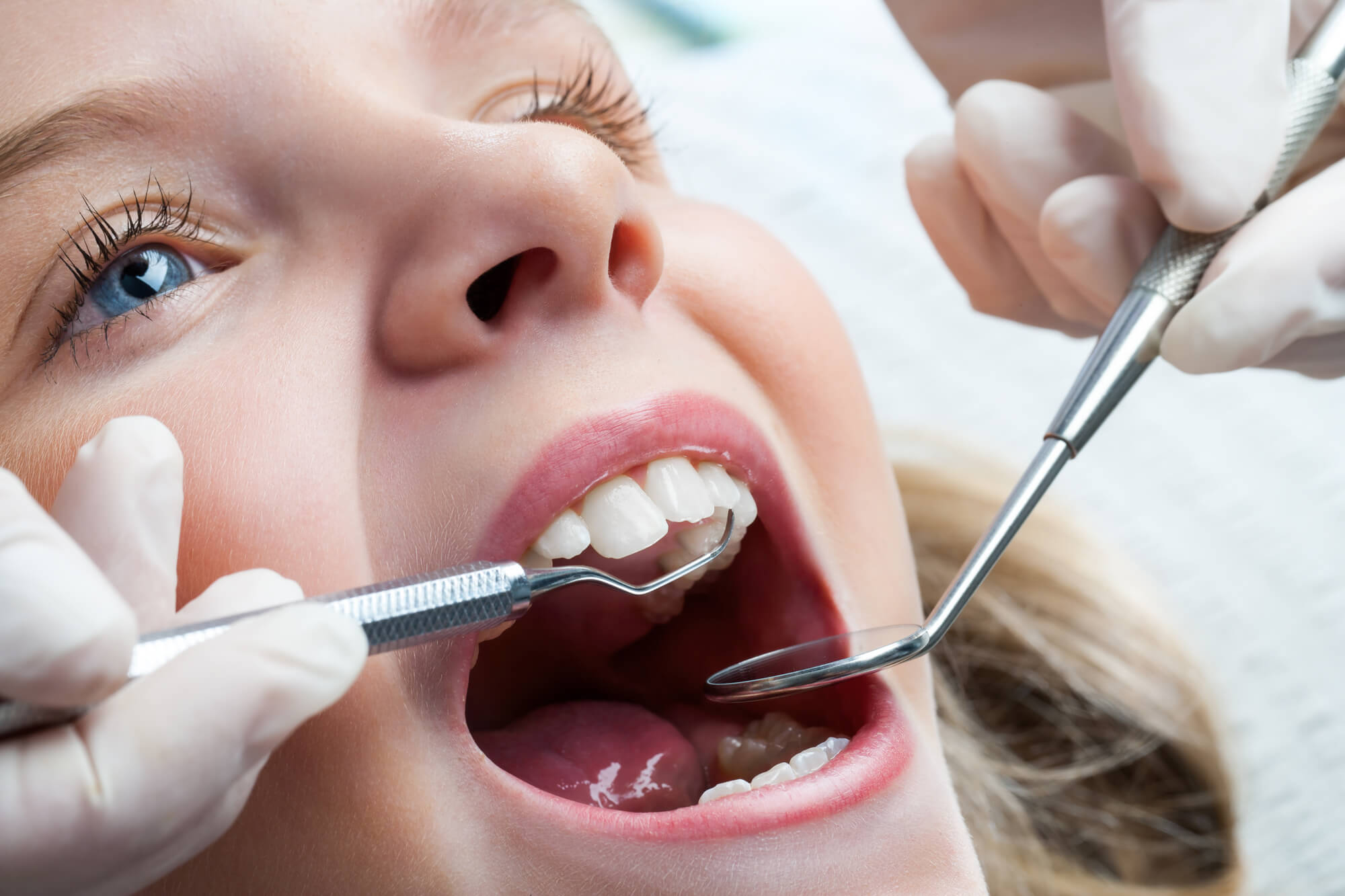 a pediatric dentist in 33146 examining a little girl's teeth
