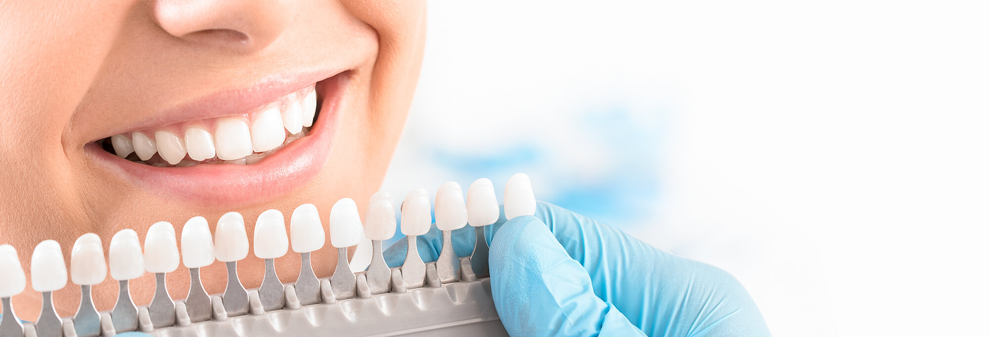 a female patient choosing the right tooth shade before getting professional Teeth Whitening in Coral Gables
