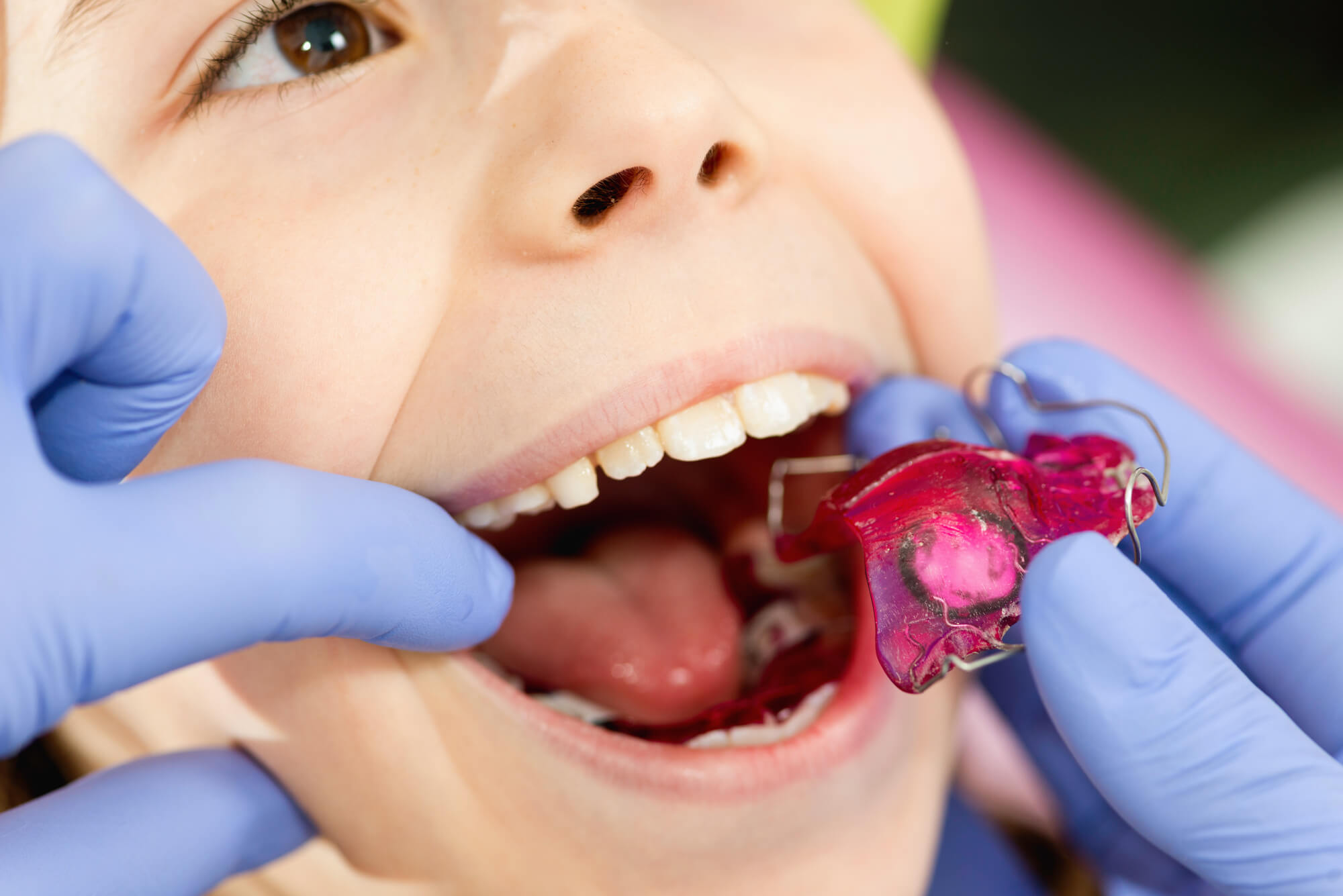 pediatric patient getting Infant Dental Exams in Coral Gables 